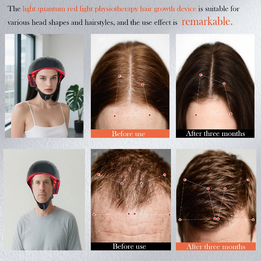 Red Light Therapy Hair Growth Helmet - Daily Use for Thicker Hair, Renew Follicles with Innovation Tech